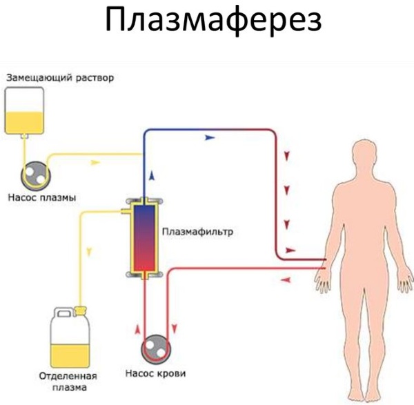 Лекарственный гепатит. Симптомы, лечение острого, хронического, рекомендации