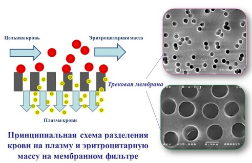 Чистка крови плазмаферез. Цена, что это такое, показания, противопоказания