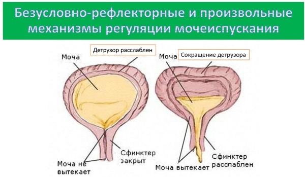 Детрузор мочевого пузыря. Что это такое, симптомы болезни, лечение у женщин, детей, мужчин