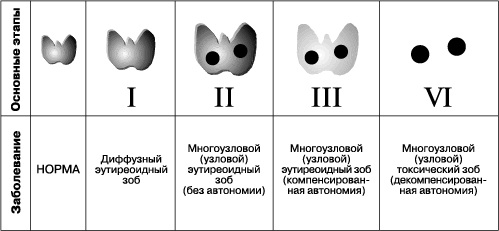 Диффузный токсический зоб. Лечение, симптомы, клинические рекомендации, диагностика