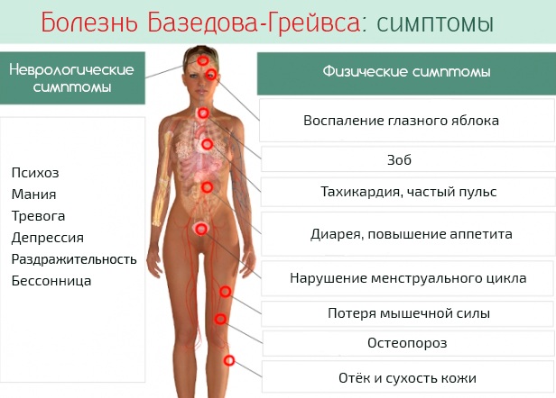 Диффузный токсический зоб. Лечение, симптомы, клинические рекомендации, диагностика