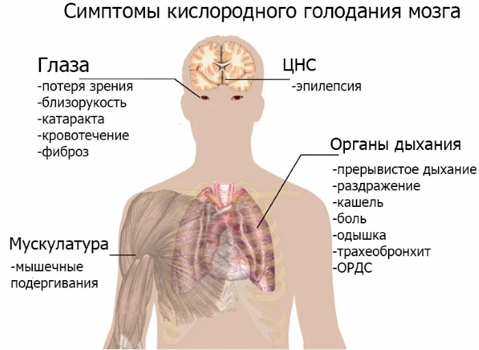 Кислородное голодание мозга. Симптомы, лечение у взрослых, детей, последствия