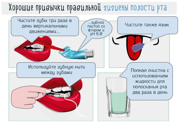 Коричневый налет на языке у взрослых, ребенка. Причины, что это может значить, как избавиться