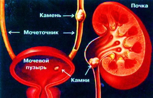 Моча коричневого цвета у женщин. Причины при цистите, беременности, климаксе, лечение