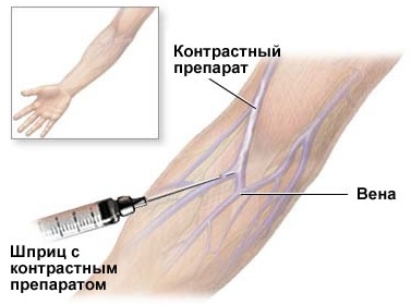 МРТ сердца. Что показывает с контрастированием и без, как делают, показания