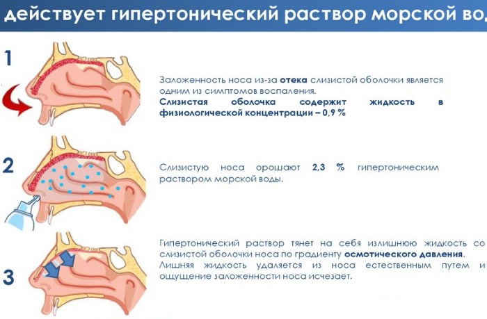 Сложные капли в нос для детей. Состав, инструкция по применению, рецепты, пропорции