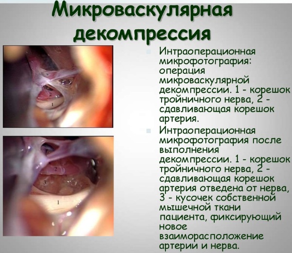 Нервные окончания человека. Схема, где находятся, лечение