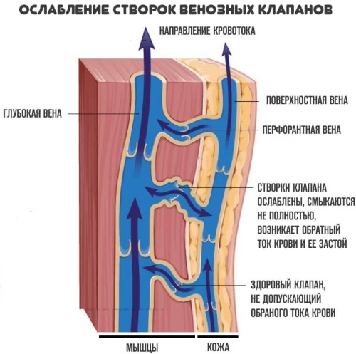 Нормавен крем для ног. Цена, инструкция по применению, аналоги