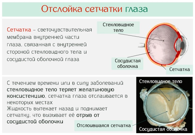 Глазное дно. Как проверяют, что показывает, норма, расшифровка