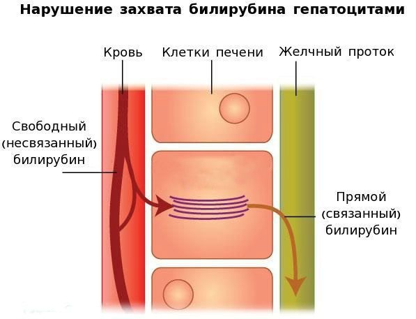 Синдром Жильбера. Симптомы и лечение, чем опасен, диагностика, клинические рекомендации