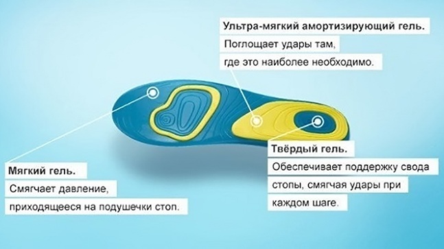 Супинаторы для стопы при плоскостопии. Где купить, как сделать, выбрать, цена, фото