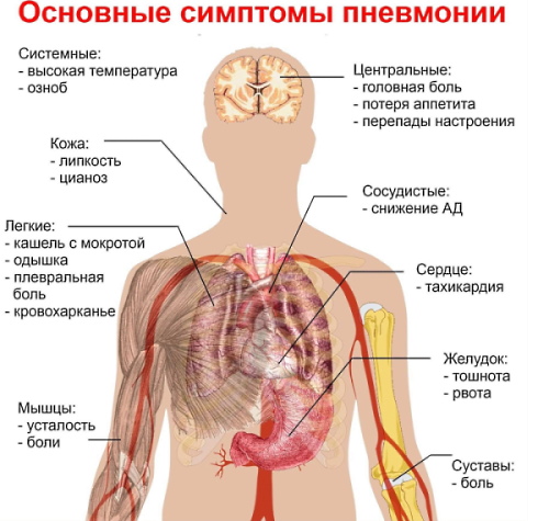 Супракс Солютаб (Suprax Solutab) 400 мг таблетки. Цена, инструкция по применению, аналоги