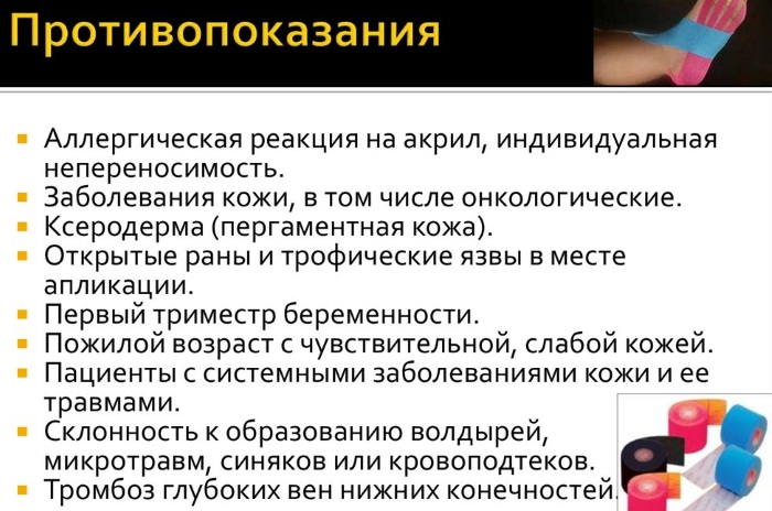 Тейпирование коленного сустава. Схемы при артрозе, растяжении связок, разрыве мениска, виды