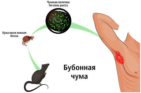 Укус блохи на человеке. Фото, как выглядит, чем лечить, профилактика, виды заболеваний