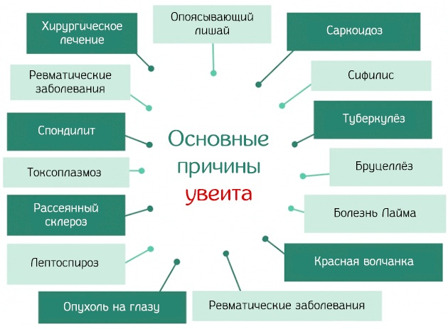 Увеит. Лечение в домашних условиях, причины, классификация