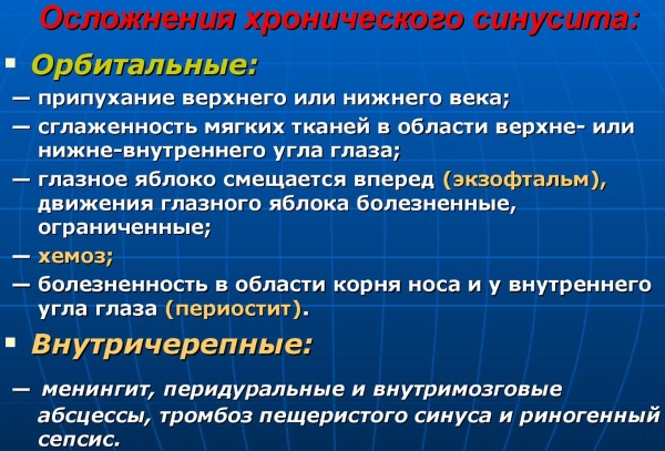 Воспаление пазух носа. Симптомы, лечение у взрослого, ребенка препаратами, народными средствами