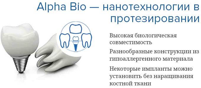 Альфа Био (Alpha Bio) импланты. Отзывы пациентов, каталог, производители, где купить, срок службы, цена