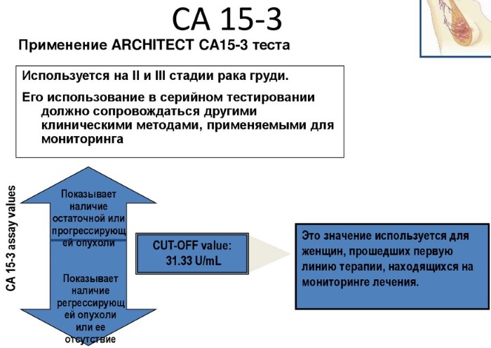 CA 15-3 онкомаркер. Норма у женщин, таблица, что это такое, расшифровка