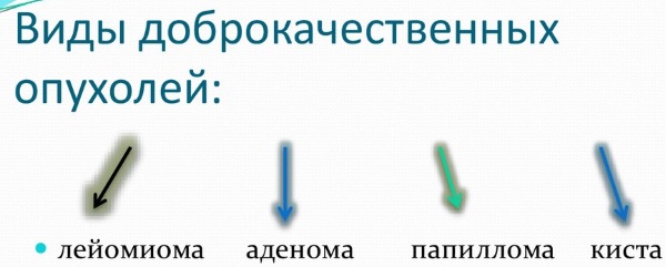 Доброкачественная и злокачественная опухоль. Отличия, таблица, можно ли отличить на взгляд