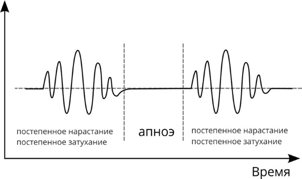 Дыхание Чейна-Стокса. Что это, причины, при каких заболеваниях бывает, как лечить