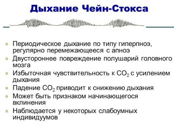 Дыхание Чейна-Стокса. Что это, причины, при каких заболеваниях бывает, как лечить