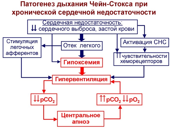 Дыхание Чейна-Стокса. Что это, причины, при каких заболеваниях бывает, как лечить