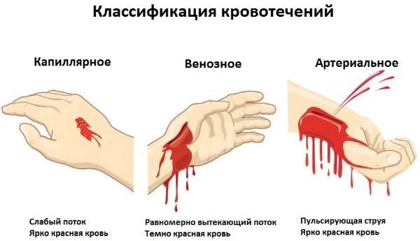 Геморрагический шок. Что это такое, степени, стадии, клинические рекомендации