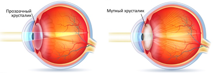 Доппельгерц (Doppelherz) витамины для глаз. Инструкция по применению с лютеином, черникой, хромом, цинком, селеном