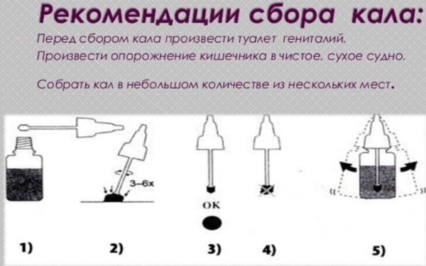 Копрологическое исследование кала. Что это, как сдавать, расшифровка, подготовка