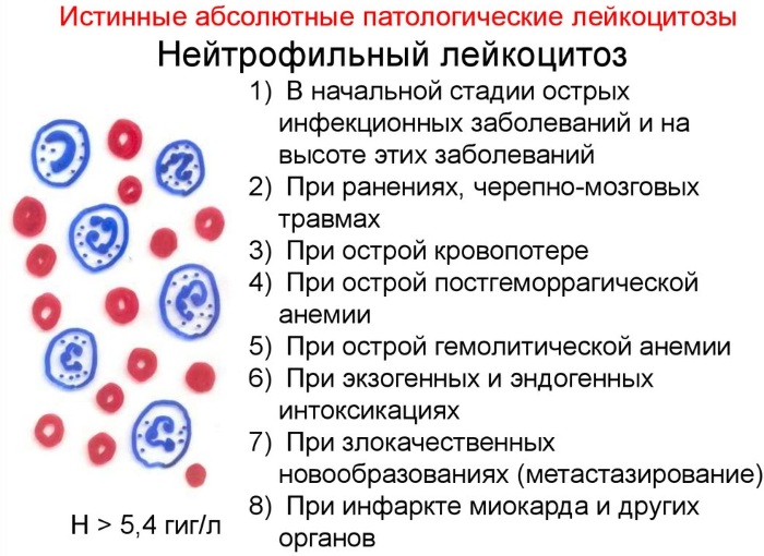 Лейкоцитоз крови. Что это такое у взрослых, ребенка, беременных, причины, лечение, последствия