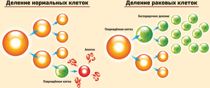 Метастазы в голове. Симптомы, признаки, лечение, прогноз срока жизни