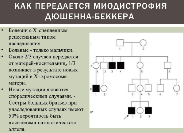 Миопатия Дюшена. Что это такое, симптомы у детей, взрослых, лечение