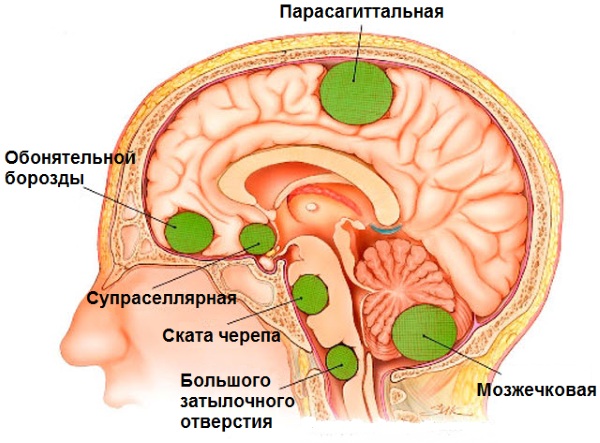 МРТ головы. Что показывает, как делают, в чем разница с контрастом и без, подготовка, показания, противопоказания