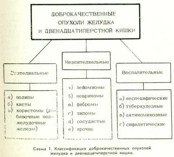 Опухоль в желудке. Симптомы, что это может быть, доброкачественная, злокачественная, лечение