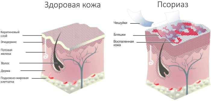 Пиритион цинка (Zinci Pyrithionum) крем. Цена, инструкция, где купить, аналоги