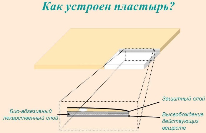 Пластырь от беременности. Цена, инструкция, какие бывают, побочные действия