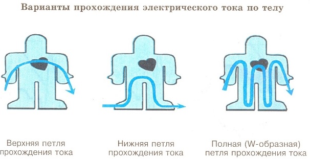 Картинка поражение током