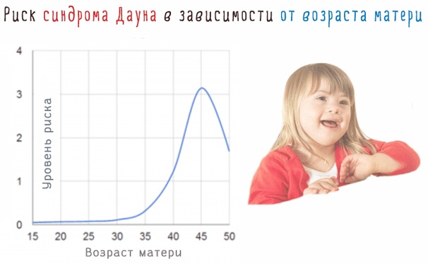 Синдром Дауна. Фото взрослых, детей, кариотип, причины, симптомы, признаки, лечение, диагностика, риск