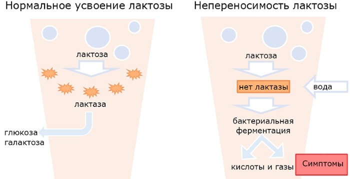 Синдром мальабсорбции. Что это у детей, взрослых, симптомы, рекомендации, лечение