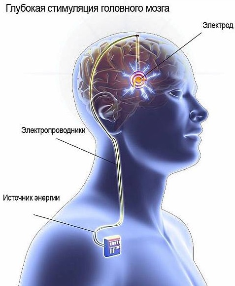 Синдром Туретта. Что это такое, из-за чего появляется, симптомы, лечение