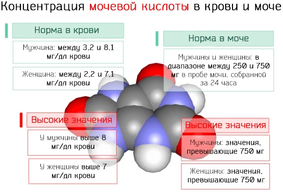 Соль в моче при беременности у женщин, ребенка, мужчин. Что это значит, причины, лечение, анализ