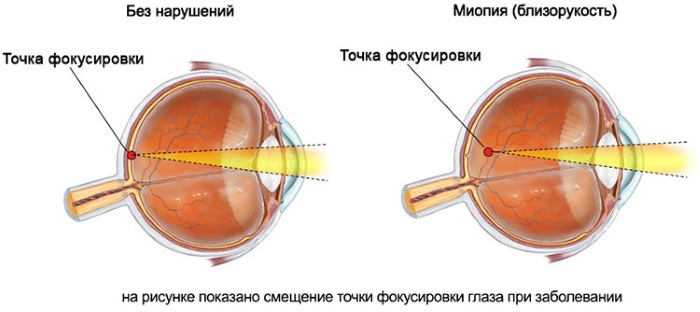 Глазное яблоко. Растет ли с рождения, строение, анатомия