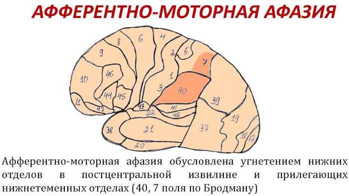 Тяжелые нарушения речи. Что это, классификация, диагнозы, причины, к чему приводят