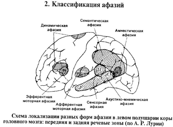 Тяжелые нарушения речи. Что это, классификация, диагнозы, причины, к чему приводят