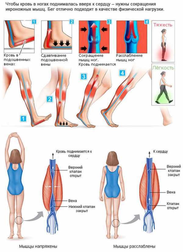 Упражнения при варикозе. Лечение нижних конечностей, ног, ягодиц, малого таза. Видео-комплекс Бубновского, и другие