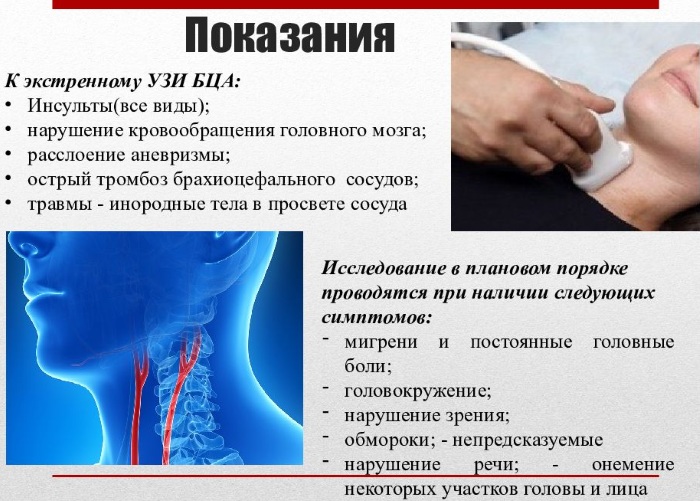 УЗДГ брахиоцефальных артерий. Что это такое, как делают, что показывает, подготовка, расшифровка