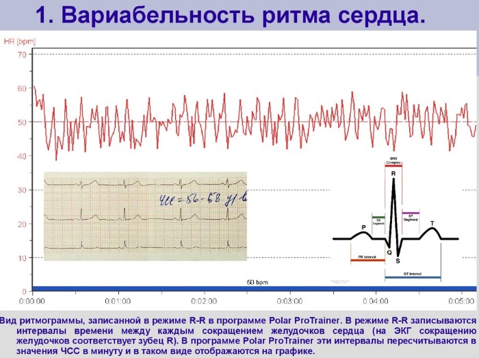 Вариабельность ритма сердца снижена. Что это значит у ребенка, плода, взрослого, лечение