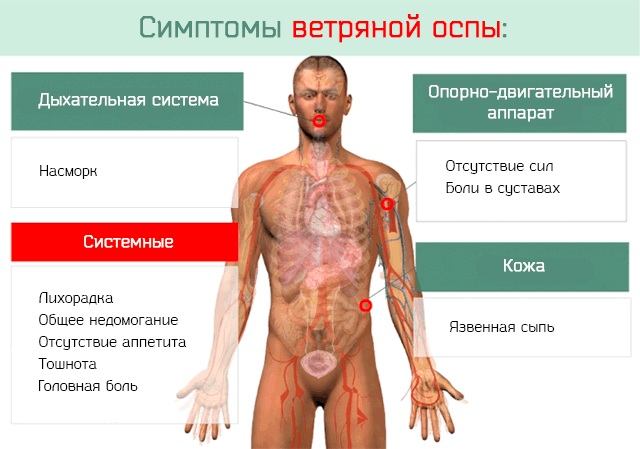 Понос при ветрянке у детей. Что делать, бывает ли