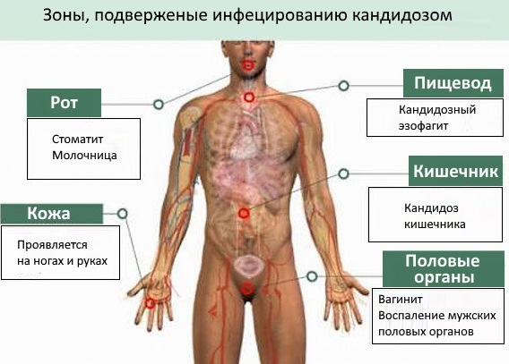 Антикандидная диета. Список продуктов, меню на неделю, рецепты