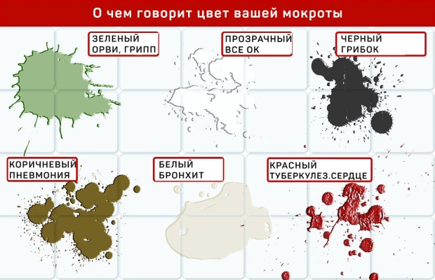 Йодная сетка при кашле взрослым как рисовать